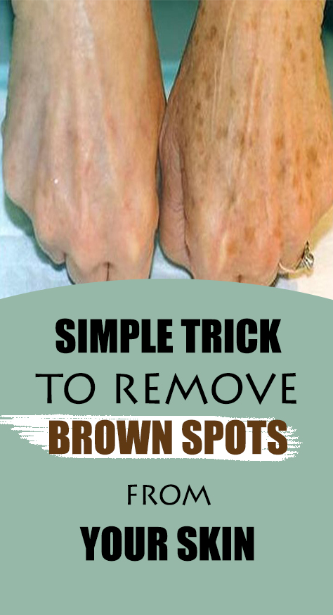 In this article we will explain why brown spots appear, what effect they can possibly have on your health and what are the best ways to remove / prevent them.