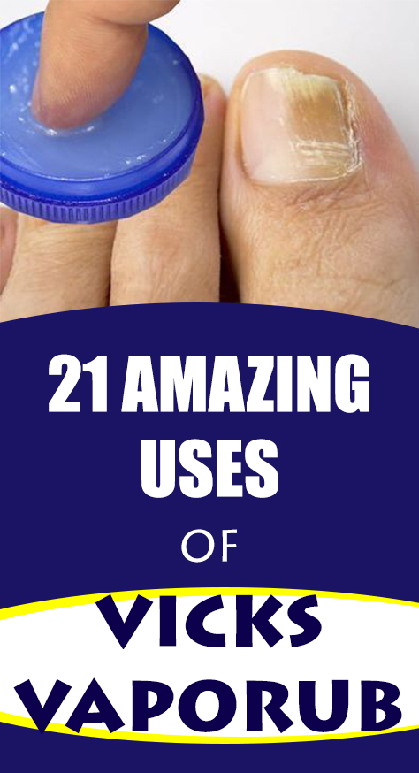 As you can see, this ointment can be used for various conditions, and in this article, we present 21 Vicks uses that you will find surprising.