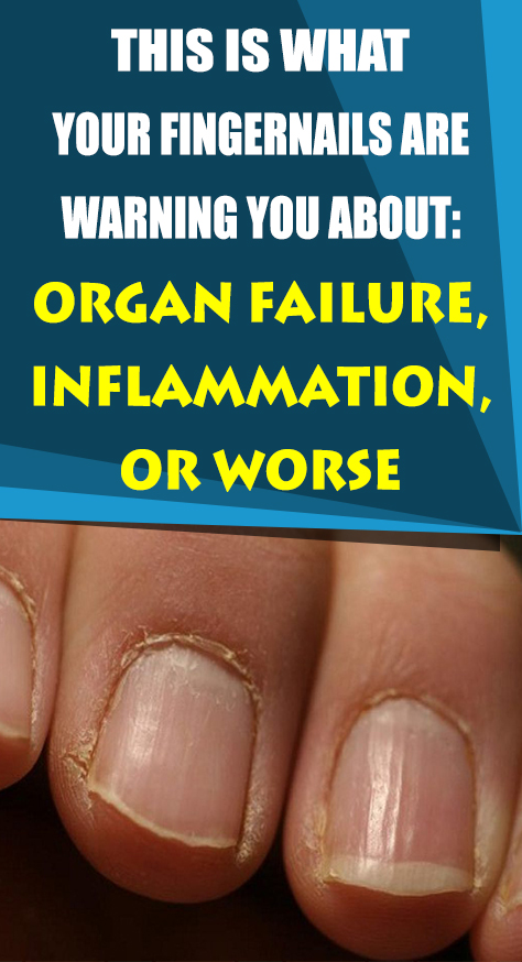 Check your memory – have your nails always looked like this? Changes to your fingernails and disease onset are linked, so note any new developments. With this fresh view, compare what you see with this list of eight potential fingernail health warnings.