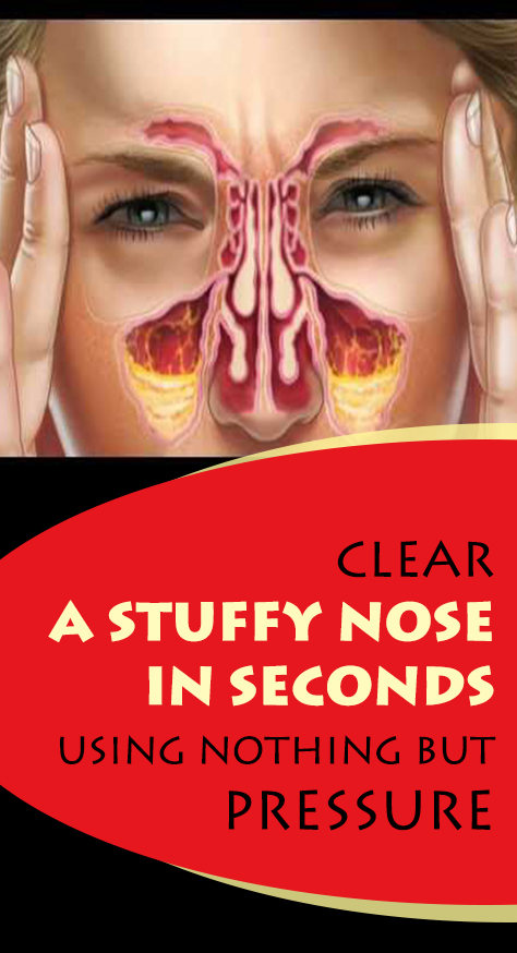 They help us breathe, and live. Interestingly, whatever keeps us alive, can also threaten our existence, similarly sinuses can put us through a hell lot of trouble if we aren’t careful.